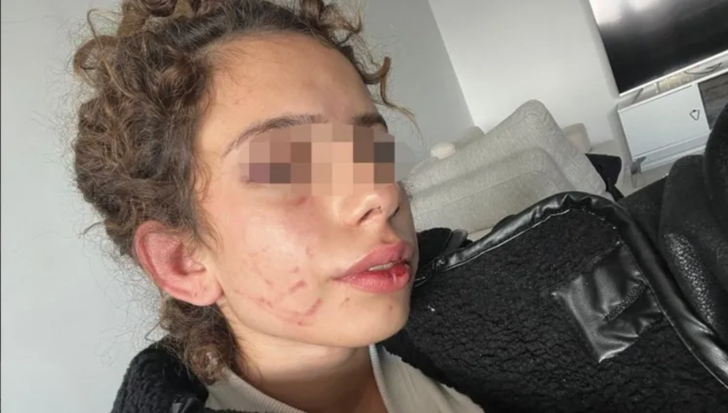 Genç kızı sabaha kadar darp etti! Kendisinden ayrılmak isteyen kadına "Sana bir sürprizim var" diyerek işkence uyguladı G2