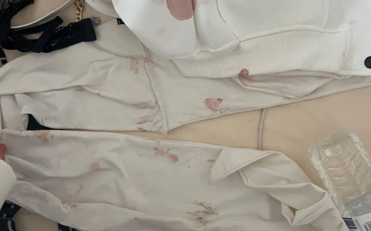 Genç kızı sabaha kadar darp etti! Kendisinden ayrılmak isteyen kadına "Sana bir sürprizim var" diyerek işkence uyguladı G5