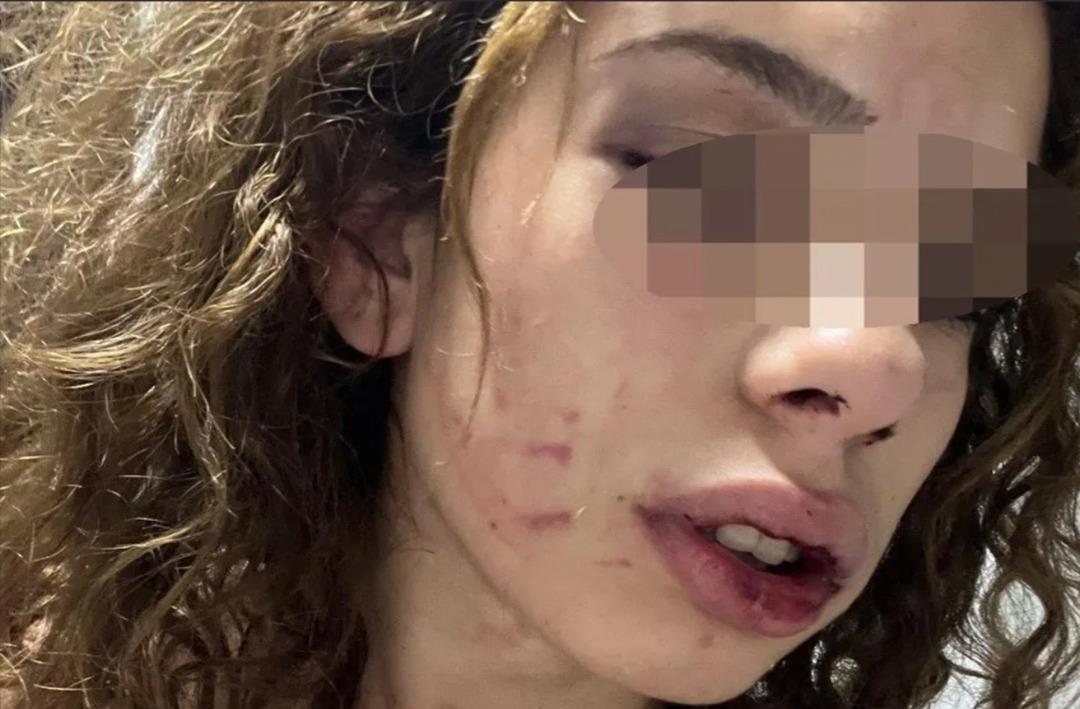 Gen&ccedil; kızı sabaha kadar darp etti! Kendisinden ayrılmak isteyen kadına "Sana bir s&uuml;rprizim var" diyerek işkence uyguladı