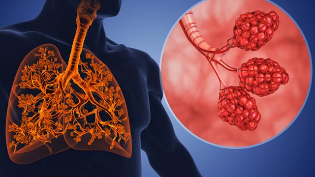 50 yıl sonra gelen devrim! Astım ve KOAH için çığır açan tedavi yöntemi keşfedildi...