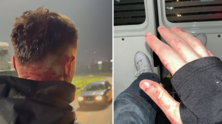 Saraybosna'da Türk taraftarlara saldırı! Bir futbolsever hastanelik oldu, 5 taraftar polis gözetimine alındı