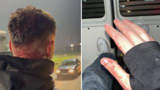 Saraybosna'da Türk taraftarlara saldırı! Bir futbolsever hastanelik oldu, 5 taraftar polis gözetimine alındı