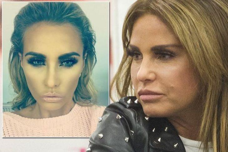 Estetik yüzünden tanınmaz hale geldi! G4