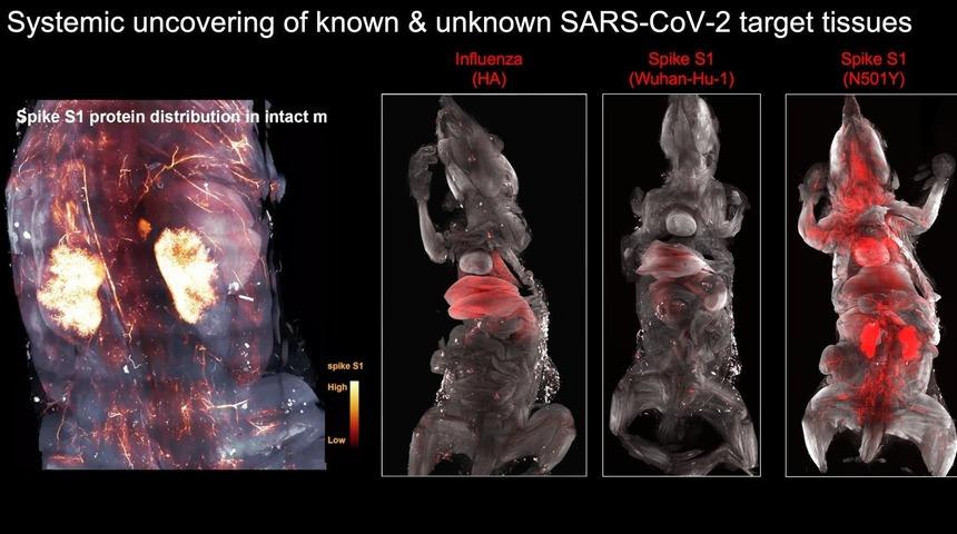 Türk profesörden ses getiren araştırma: Covid-19 kafatasında bekleyip beyne sinsice sızıyor! Hastalık atlatılsa bile yıllarca kalıyor 'Pandemiden daha etkili'