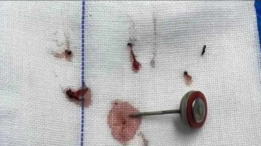 Sadece tek bir ısırık! 2 yaşındaki pili ısıran çocuk hastanelik oldu: Önce patlama sonra çığlık...