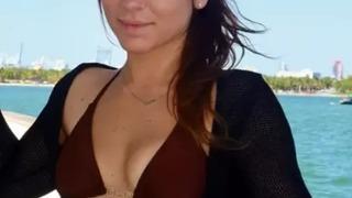 Kendisine doğum günü hediyesi olarak almıştı! Yağ eriten enjeksiyon yaptırmıştı... Et yiyen enfeksiyon kaptı... Derim patladı