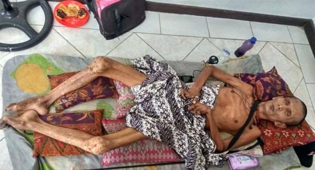 V&uuml;cudu `taşlaşıyor`