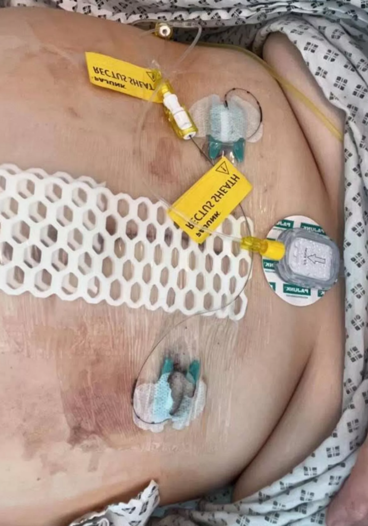 Hamile olduğunu sandılar! Karnından çıkanı gören uzaylıya benzetti: Tam 19 kilo!  G5