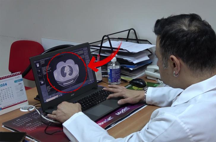 Ayağında kaşıntıdan hastaneye başvurdu, 100 binde 1 görülen hastalık teşhisi kondu!