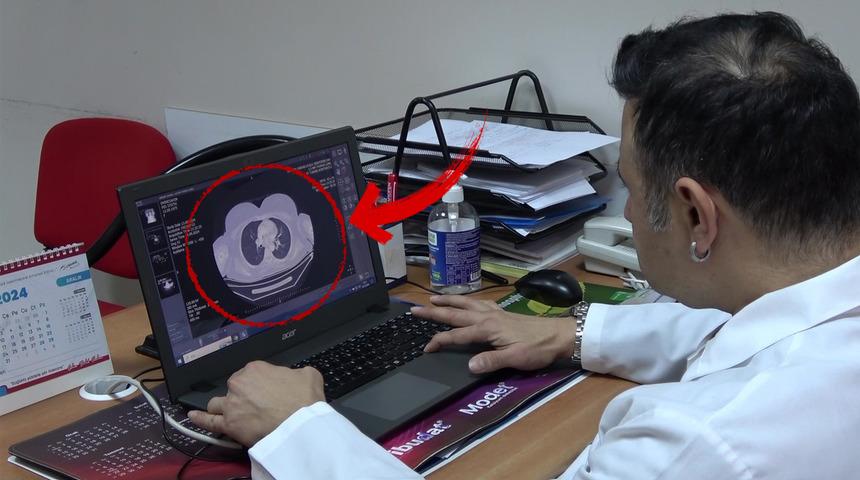 Ayağında kaşıntıdan hastaneye başvurdu, 100 binde 1 g&ouml;r&uuml;len hastalık teşhisi kondu!