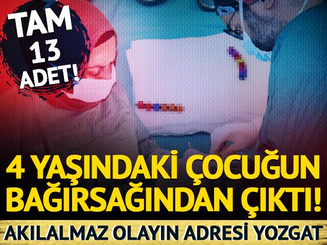 Akılalmaz olayın adresi bu kez Yozgat! 4 yaşındaki çocuğun bağırsağından çıktı