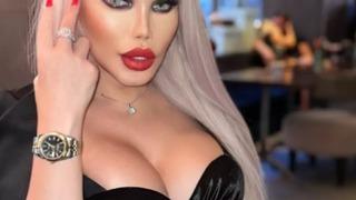 100'den fazla estetik operasyon geçirdi! Kaburgasını bile aldırdı... Milyonlarca lira harcadı: Öz sevgime yaptığım bir yatırım