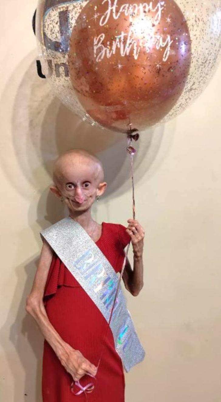 Her doğum gününde 8 yaş birden yaşlandı! TikTok fenomeni Beandri Booysen 19 yaşında hayatını kaybetti: '152 yıl yaşlandı' G1