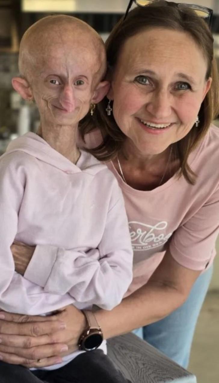 Her doğum gününde 8 yaş birden yaşlandı! TikTok fenomeni Beandri Booysen 19 yaşında hayatını kaybetti: '152 yıl yaşlandı' G2