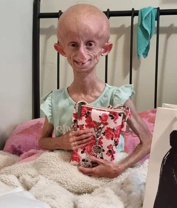 Her doğum gününde 8 yaş birden yaşlandı! TikTok fenomeni Beandri Booysen 19 yaşında hayatını kaybetti: '152 yıl yaşlandı' G3