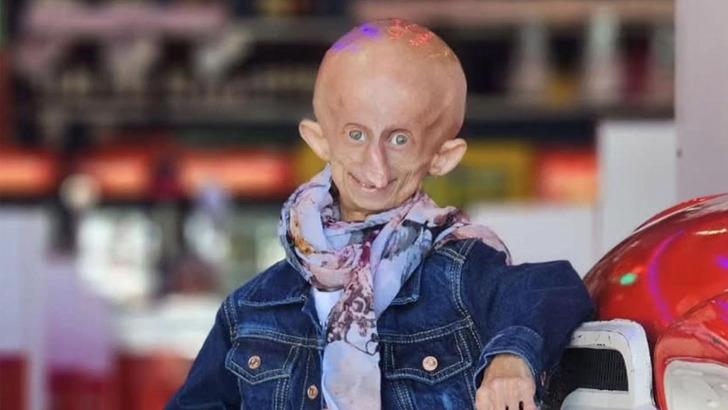 Her doğum gününde 8 yaş birden yaşlandı! TikTok fenomeni Beandri Booysen 19 yaşında hayatını kaybetti: '152 yıl yaşlandı' G4