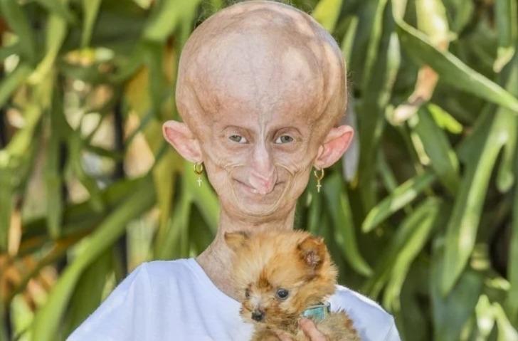 Her doğum gününde 8 yaş birden yaşlandı! TikTok fenomeni Beandri Booysen 19 yaşında hayatını kaybetti: '152 yıl yaşlandı' G5