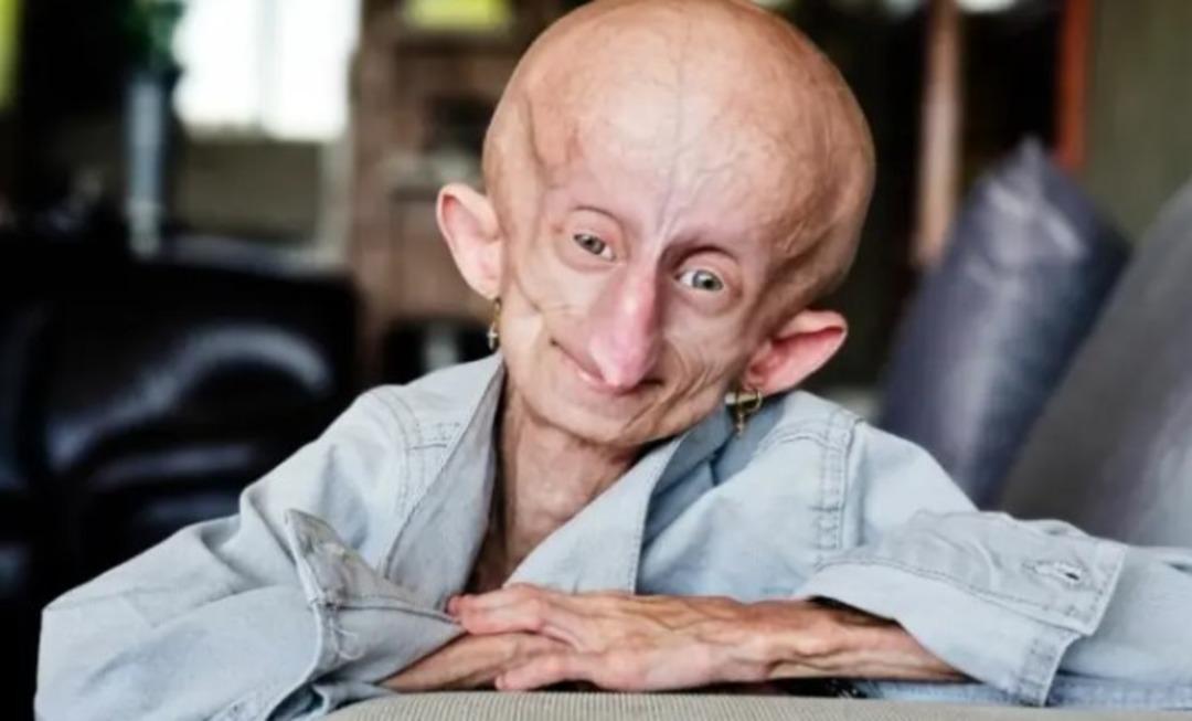 Her doğum g&uuml;n&uuml;nde 8 yaş birden yaşlandı! TikTok fenomeni Beandri Booysen 19 yaşında hayatını kaybetti: '152 yıl yaşlandı'