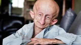 Her doğum gününde 8 yaş birden yaşlandı! TikTok fenomeni Beandri Booysen 19 yaşında hayatını kaybetti: '152 yıl yaşlandı'