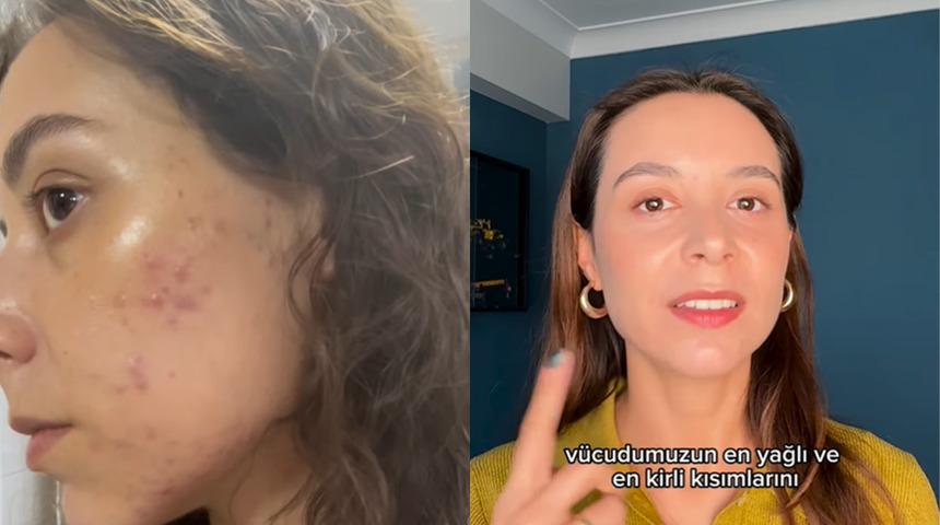 Yastık kılıfının y&uuml;z&uuml;n&uuml; ne hale getirdiğini paylaşan kadın g&uuml;ndem oldu! 'Klozetten 17 bin kat daha fazla bakteri barındırıyor'