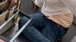 Korku dolu anlar! Bacağı havaalanındaki yürüyen merdiven sıkışınca kesilmek zorunda kaldı