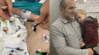 2 yaşındaki çocuk 1,5 aydır öksürük nöbeti geçiriyordu! Sebebi akciğerindeki fındık çıktı