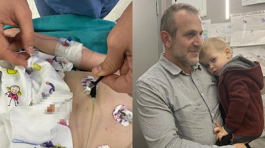 2 yaşındaki çocuk 1,5 aydır öksürük nöbeti geçiriyordu! Sebebi akciğerindeki fındık çıktı