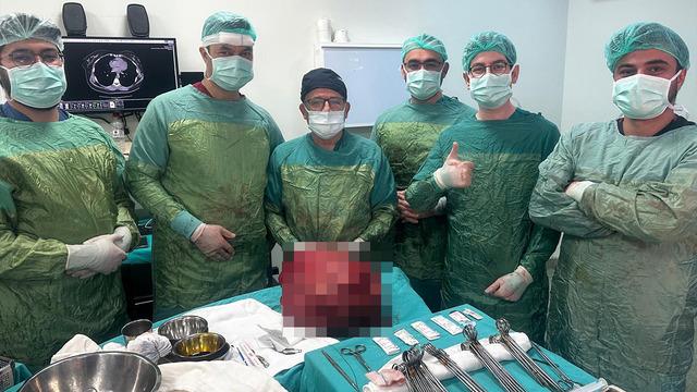 Tam 13 kilo! Doktor bile şaşkına döndü... 30 yıllık meslek hayatımda çıkarttığım en büyük diyerek anlattı