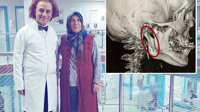 15 yıldır yaşıyor, bazen çığlık atası geliyordu! Ağrı kesicilerin de pek işe yaramadığı boyun ağrısının nedeni ortaya çıktı: Nadir görülüyor