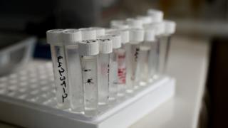 Yılbaşı öncesi 'kozmetik alkol' uyarısı: Gözle ve kokuyla ayırt edilmiyor! 'Numunelerin yüzde 95'i kayıt dışı' Ölüme kadar gidebiliyor!