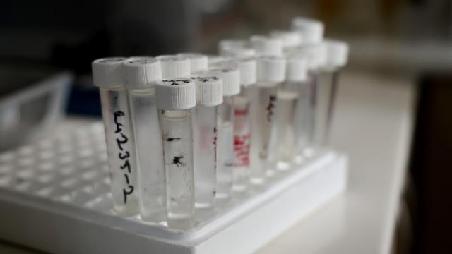 Yılbaşı öncesi 'kozmetik alkol' uyarısı: Gözle ve kokuyla ayırt edilmiyor! 'Numunelerin yüzde 95'i kayıt dışı' Ölüme kadar gidebiliyor!