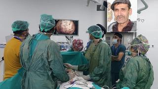 Yemekten sonra karnı şişip kusuyordu! 10 kattan fazla büyüyen midesi 20 yıllık doktoru bile şaşırttı