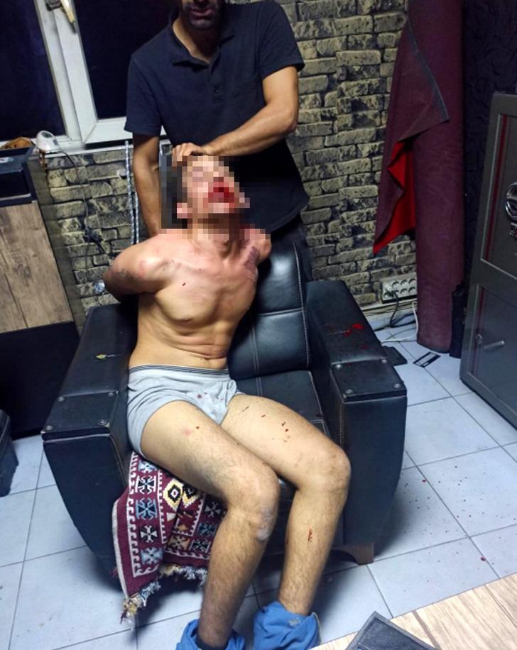 3 gün işkence edilip, böcek yedirilmiş! İnsanlık dışı olaylara maruz kalan Vedat Kurt yaşadıklarını anlattı... G2