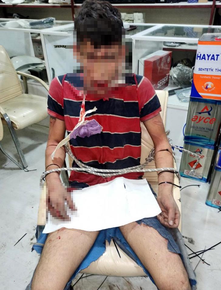 3 gün işkence edilip, böcek yedirilmiş! İnsanlık dışı olaylara maruz kalan Vedat Kurt yaşadıklarını anlattı... G3