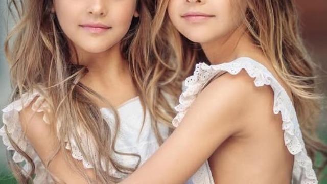 'Dünyanın en güzel ikizleri' olarak anılıyorlardı! Artık büyüdüler: Son hallerini gören gözlerine inanamadı