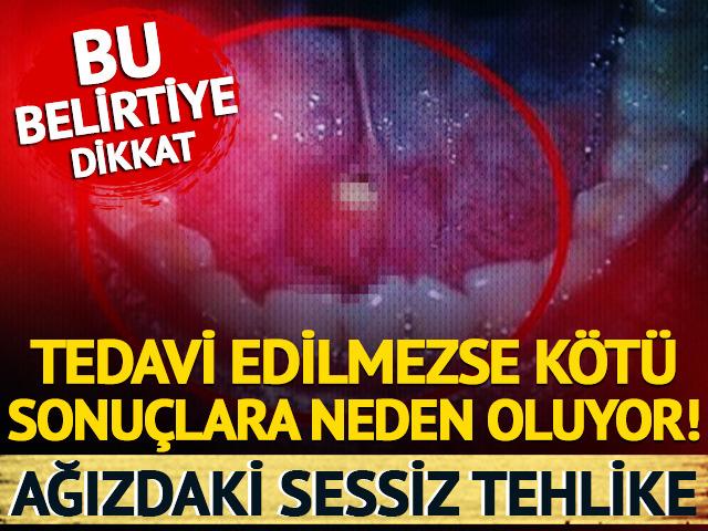 Ağızdaki sessiz tehlike: Bu belirtiye dikkat!