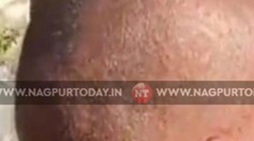 Hindistan'da bir anda ortaya çıktı! 'Gizemli virüs' denildi: Yüzlerce kişiyi aniden kel bıraktı... Kimse nedenini anlayamadı