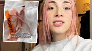 Daha ince bir bele sahip olmak için kaburgalarını aldırdı! 17.000 dolar (601 bin TL) harcadı: Onları taç haline getireceğim