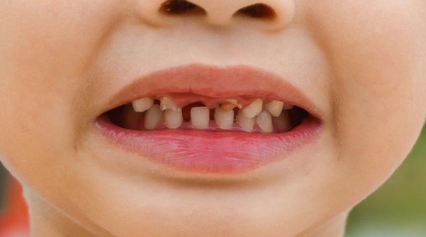 Her g&uuml;n kola i&ccedil;tiğinizde v&uuml;cudunuzda bunlar oluyor!