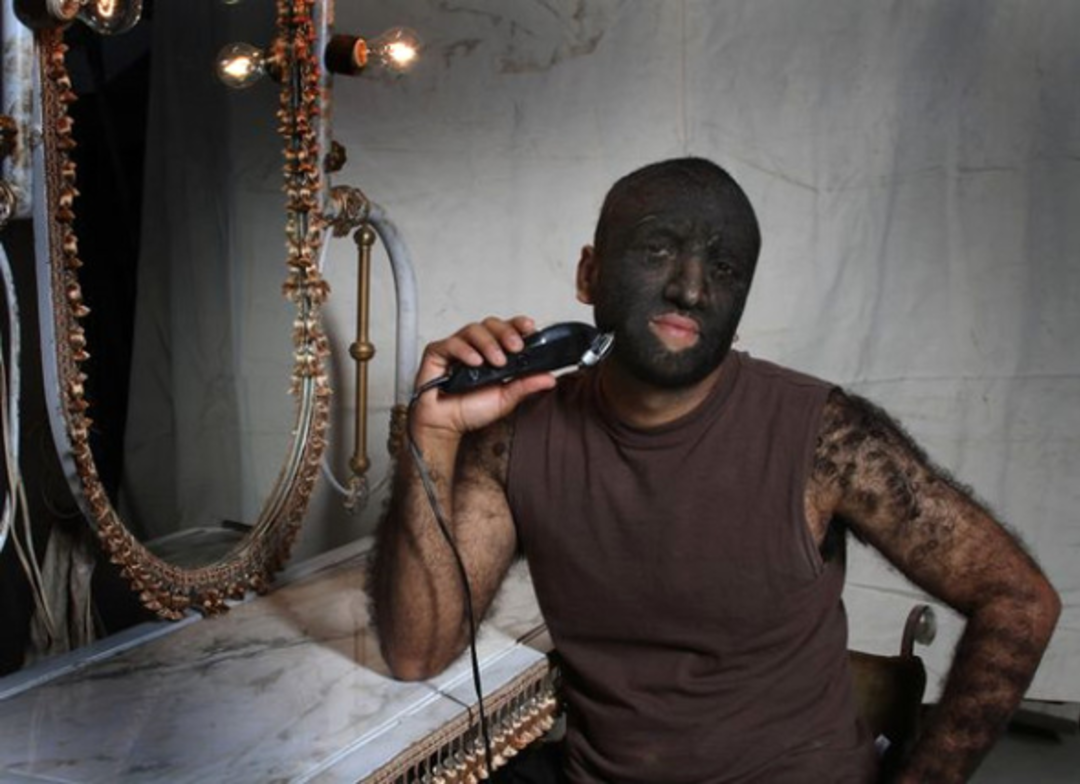 D&uuml;nyanın en kıllı adamı artık &ccedil;ok mutlu!