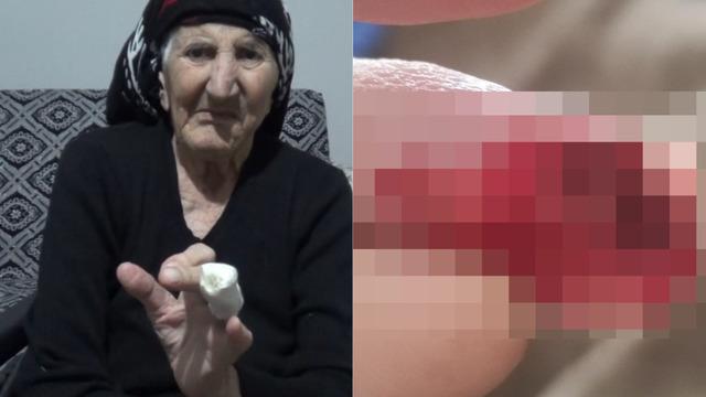 Herkesin başına gelebilir! MR'a giren kadın kabusu yaşadı! Uzvunu kaybetme tehlikesiyle karşı karşıya...