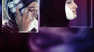 MasterChef'te yüzü yandı 'kurgu' dendi! Beyza Huri Aydın yanan yüzünün en net halini ilk kez yayınladı! Sosyal medyada yorum yağdı