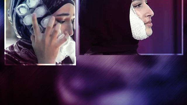 MasterChef'te yüzü yandı 'kurgu' dendi! Beyza Huri Aydın yanan yüzünün en net halini ilk kez yayınladı! Sosyal medyada yorum yağdı