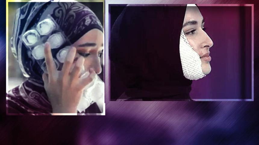 MasterChef'te yüzü yandı 'kurgu' dendi! Beyza Huri Aydın yanan yüzünün en net halini ilk kez yayınladı! Sosyal medyada yorum yağdı