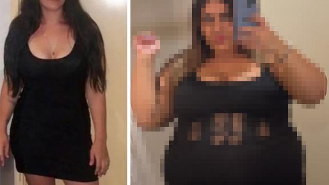 Herkes kilo vermeye çalışırken o kilo alma sürecini paylaştı! Öncesi ve sonrası halini görenler inanamadı: Bunu kendine neden yaptı?