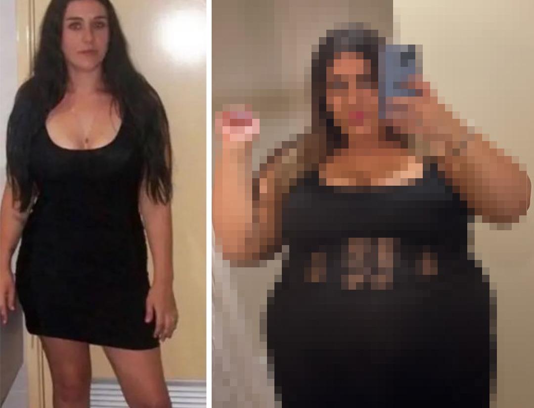 Herkes kilo vermeye &ccedil;alışırken o kilo alma s&uuml;recini paylaştı! &Ouml;ncesi ve sonrası halini g&ouml;renler inanamadı: "Bunu kendine neden yaptı?"