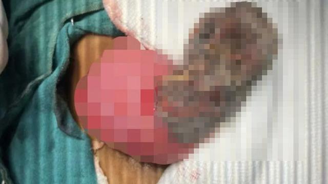 4 yaşındaki çocuğun midesinden saç yumağı çıktı! Doktorları şaşkına çevirdi: Kuyruğu bile vardı