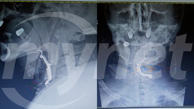 İddia çok büyük... Öyle bir şey unuttular ki ölüme sebep oldu! Üstüne evrakla sahtecilikle olay örtbas edildi