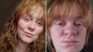 Sosyal medyayı şaşırtan görüntü! Hamilelikten sonra burun ölçüleri değişti: Burnum iki katına çıktı