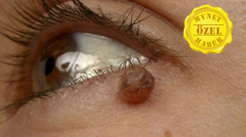 Kendi yöntemlerinizle düşürmeye çalışmayın!